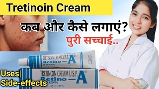 Retino a 0025 cream review  tretinoin Cream 0025 before and after  By Drx Pranjali Satpute [upl. by Tamara387]