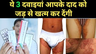 Jock itch  दाद का सबसे गंभीर रूप 5 दिन में चला जाएगा  jock itch treatment  दाद का इलाज [upl. by Nezam417]