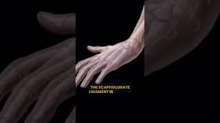 scapholunate ligament tear [upl. by Sanyu]