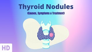 Thyroid Nodules Causes Symptoms and Treatment [upl. by Dalenna380]