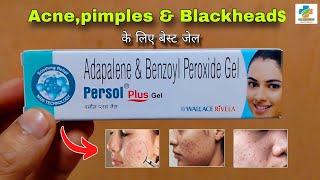 Persol Plus Gel Use in Hindi  Acnepimples Blackhead  Adapalene amp Benzoyl peroxide SK MEDICINE [upl. by Amitarp]