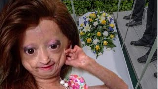 RIP Youtuber Adalia Rose Died Last Moment With her Mother😭This is so sd [upl. by Peedus]