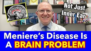 Why Meniere’s Disease Is a BRAIN Problem not JUST balance vertigo hearing tinnitus [upl. by Orland329]