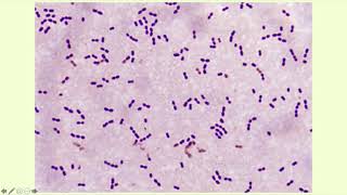 AlphaHemolytic Streptococci  Microbiology Boot Camp [upl. by Reel]