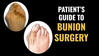 Patients Guide to Bunion Surgery [upl. by Fawcette]