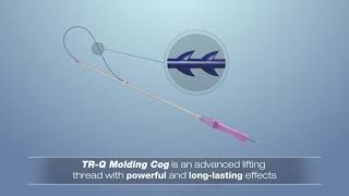 TRQ Thread Queen Molding Cog Thread Lift [upl. by Bria158]