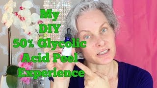 30 Glycolic Acid Peel At Home Demo and Pictures [upl. by Eniretac670]