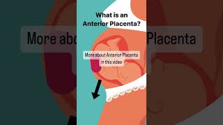 What is Anterior Placenta pregnant [upl. by Isis878]