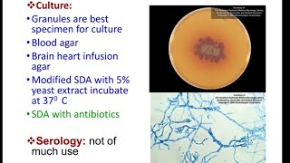 Subcutaneous Mycosis  mycetoma MICROBIOLOGY [upl. by Otreblasiul34]