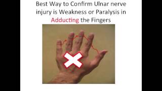 Ulnar Nerve Test [upl. by Ailegna659]