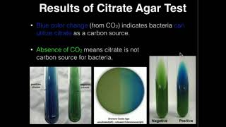 Microbiology Citrate Agar [upl. by Loleta]