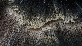 ASMR Immersive Scalp Examination No Talking 42 [upl. by Negaem]