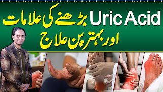 Uric Acid Symptoms and Treatment  Uric Acid Diet Plan and Foods To Avoid  Uric Acid Ka ilaj [upl. by Leahcimed]