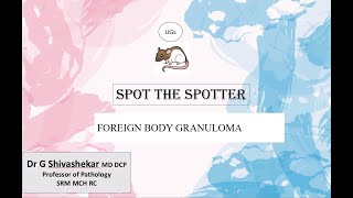 FOREIGN BODY GRANULOMA UG SPOTTERS  RATS  MBBS SRMMCM RC  Dr GSS [upl. by Orecic667]