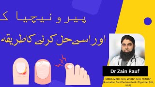 What is PARONYCHIA Its a nail infection  Solve Paronychia  In Urdu [upl. by Dante785]