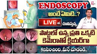 కడుపులో సమస్యలు  Know About Colonoscopy And Endoscopy  Gleneagles Hospital  DrGSSameer Kumar [upl. by Vic]