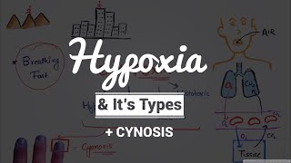 Hypoxia amp Cyanosis Causes amp PathogenesisTypes of Hypoxia Hypoxic  Anemic  Stagnant  Histotoxic [upl. by Norramic]