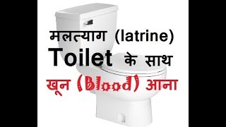 मलत्याग latrine potty करने के बाद या पहले खून blood आना – black brown blood in stool in Hindi [upl. by Adal]