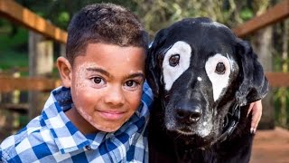 8YearOld Boy Embarrassed Of Vitiligo Meets Dog With Same Skin Condition [upl. by Nednal]