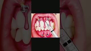 ASMR Treatment  2D Animation Surgery Pabi ASMR asmr 3danimationsurgery 2danimation treatment [upl. by Yereffej]