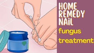 Get Rid of Toenail Fungus Fast My Top 6 Home Remedies [upl. by Idnod172]