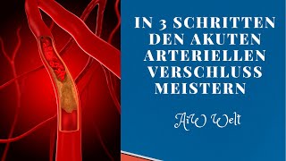 In 3 Schritten den akuten arteriellen Verschluss meistern [upl. by Hedda]