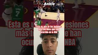 Lesiones deportivas Luxación y fractura de tobillo en jugador de NBA fisioterapia kinesiologia [upl. by Gyasi448]