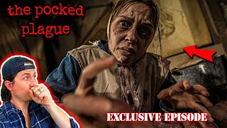 MrBallen Podcast  The pocked plague PODCAST EXCLUSIVE EPISODE [upl. by Lertnahs]