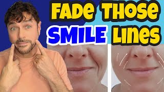 5 Ways To Fade SMILE LINES Marionette Lines  Chris Gibson [upl. by Decato]