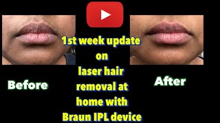 1st SessionHair Removal at homeBraun IPLtamiltrendingbraunfacialhairremovalforwomen [upl. by Ynaffet217]