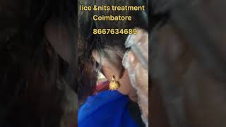 how to remove nits and lice nits hair nitsremoval peenu hairstyle lice lice treatment eeru [upl. by Aural]