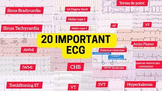 Most Important ECG ecg ecg reading medicine basic of ECG [upl. by Wrench]