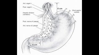 Discuss Nerves of Latarjet Laterjet or Posterior nerves of lesser curvature of the stomach [upl. by Fielding]