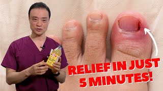 6 HOME REMEDIES To Treat A PAINFUL Ingrown Nail  Dr Kim [upl. by Brody327]