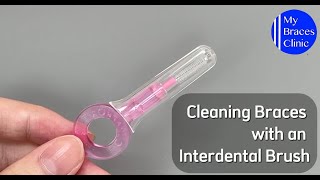 Cleaning Braces with an Interdental Brush [upl. by Ttennaej]