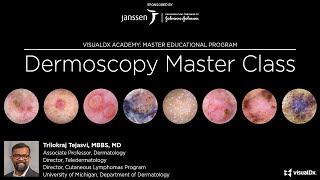 Dermoscopy Master Class [upl. by Airemaj]