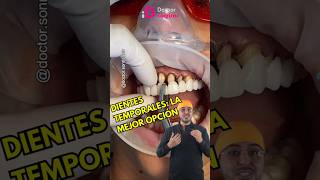 Para que son los provisionales protesisdental carillasdentales protesista dentista shorts [upl. by Urbas198]