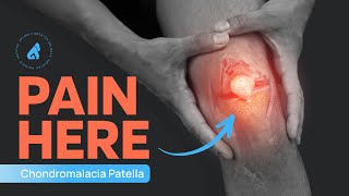 Chondromalacia Patellae  Runner’s Knee  Knee Pain Exercises  Knee Cap Pain [upl. by Atnom]