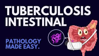 Intestinal Tuberculosis in 7 mins l Pathology Made Easy [upl. by Drwde880]