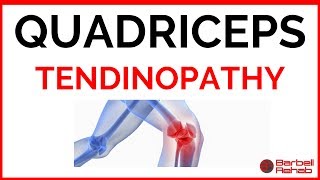 How to Manage Quadriceps Tendinopathy [upl. by Liddy267]