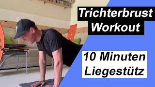 TRICHTERBRUST Workout  10 Minuten LIEGESTÜTZ [upl. by Giulia735]