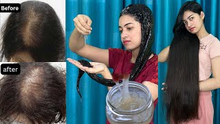 1 महीने में Flaxseeds Gel से Hair को Grow करने का तरीक़ा जो किसी ने नहीं बताया होगा  Shanu Priya [upl. by Reginald]