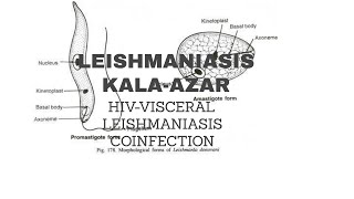 11LEISHMANIASISHIVVISCERAL LEISHMANIASIS COINFECTION [upl. by Dean]