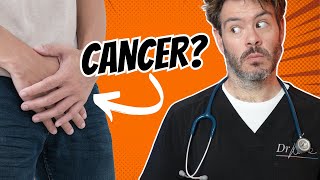 The 4 Signs of Testicular Cancer [upl. by Ytsrik]