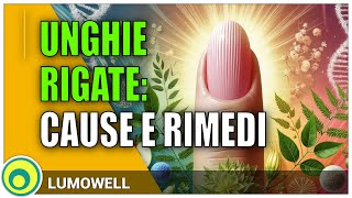 Unghie rigate cause e rimedi [upl. by Broadbent]