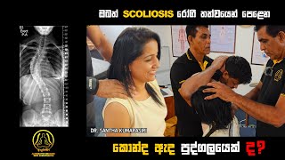 SCOLIOSIS TRATMENT  SRI LANKA CHIROPRACTIC [upl. by Outhe]