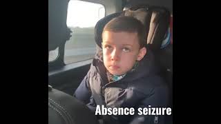 absence seizurepetit mal seizure [upl. by Bachman]