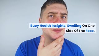 Swelling on One Side of the Face Common Causes and When to Seek Medical Care  BuoyHealthcom [upl. by Noside]