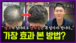 이걸 모르니까 머리가 계속 빠지는 겁니다…  카이스트 출신 의사가 탈모에 진짜 효과 본 방법 5가지 [upl. by Suivatnom]