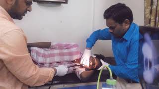 Endoscopy started at Nandini clinic pimpri [upl. by Gnilsia]